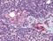 Lysine Demethylase 4A antibody, orb94323, Biorbyt, Immunohistochemistry paraffin image 