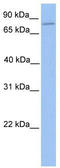 Zinc Finger Protein 555 antibody, TA345565, Origene, Western Blot image 