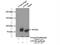 Carnitine Palmitoyltransferase 1C antibody, 22170-1-AP, Proteintech Group, Immunoprecipitation image 