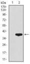 CD59 Molecule (CD59 Blood Group) antibody, GTX60658, GeneTex, Western Blot image 