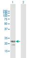 T Cell Receptor Gamma Variable 3 antibody, H00006976-B01P, Novus Biologicals, Western Blot image 