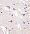 Fatty Acid Desaturase 2 antibody, LS-C165915, Lifespan Biosciences, Immunohistochemistry paraffin image 