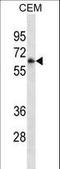 CD16 antibody, LS-C159636, Lifespan Biosciences, Western Blot image 