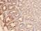 Mucin 5B, Oligomeric Mucus/Gel-Forming antibody, MA1061, Boster Biological Technology, Immunohistochemistry paraffin image 