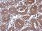 Protein Phosphatase, Mg2+/Mn2+ Dependent 1J antibody, NBP2-19902, Novus Biologicals, Immunohistochemistry paraffin image 