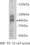 Chromogranin A antibody, MBS355098, MyBioSource, Western Blot image 