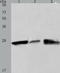 Programmed Cell Death 10 antibody, TA322435, Origene, Western Blot image 