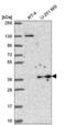 Yip1 Domain Family Member 3 antibody, NBP2-56181, Novus Biologicals, Western Blot image 