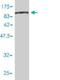 CTP Synthase 1 antibody, H00001503-M01, Novus Biologicals, Western Blot image 