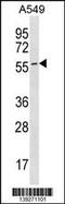 Endothelial Cell Adhesion Molecule antibody, 60-007, ProSci, Western Blot image 