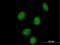 Single Stranded DNA Binding Protein 2 antibody, H00023635-B01P, Novus Biologicals, Immunofluorescence image 