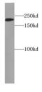 Myosin-2 antibody, FNab05474, FineTest, Western Blot image 