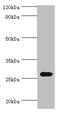 Cysteine Rich Secretory Protein 2 antibody, orb352897, Biorbyt, Western Blot image 