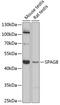 Sperm Associated Antigen 8 antibody, 23-762, ProSci, Western Blot image 