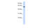 E3 ubiquitin-protein ligase TRIM41 antibody, 25-235, ProSci, Western Blot image 