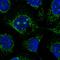 Coiled-Coil Domain Containing 58 antibody, HPA051965, Atlas Antibodies, Immunofluorescence image 