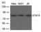 Signal Transducer And Activator Of Transcription 4 antibody, GTX50403, GeneTex, Western Blot image 