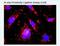 Colony Stimulating Factor 2 Receptor Alpha Subunit antibody, H00001438-M03, Novus Biologicals, Proximity Ligation Assay image 