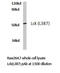 LCK Proto-Oncogene, Src Family Tyrosine Kinase antibody, LS-C177644, Lifespan Biosciences, Western Blot image 