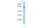 Acyl-CoA Synthetase Short Chain Family Member 1 antibody, GTX16565, GeneTex, Western Blot image 