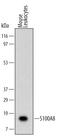 S100 Calcium Binding Protein A8 antibody, MAB3059, R&D Systems, Western Blot image 