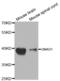 Guanine nucleotide-binding protein G(o) subunit alpha antibody, abx001952, Abbexa, Western Blot image 