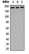 Ras Responsive Element Binding Protein 1 antibody, orb315698, Biorbyt, Western Blot image 