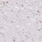 Frizzled Class Receptor 5 antibody, NBP2-49040, Novus Biologicals, Immunohistochemistry paraffin image 