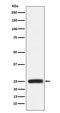 Growth Factor Receptor Bound Protein 2 antibody, M00351, Boster Biological Technology, Western Blot image 