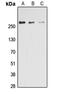 Acetyl-CoA Carboxylase Alpha antibody, LS-C368566, Lifespan Biosciences, Western Blot image 