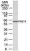 Coactivator Associated Arginine Methyltransferase 1 antibody, PA1-41103, Invitrogen Antibodies, Western Blot image 