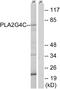 Cytosolic phospholipase A2 gamma antibody, A30634, Boster Biological Technology, Western Blot image 