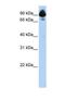 Regulator Of G Protein Signaling 3 antibody, PA1-24310, Invitrogen Antibodies, Western Blot image 