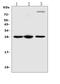 Triggering Receptor Expressed On Myeloid Cells 1 antibody, A02135-2, Boster Biological Technology, Western Blot image 