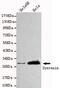 Syndecan Binding Protein antibody, GTX49226, GeneTex, Western Blot image 