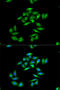 Carnitine Palmitoyltransferase 1A antibody, STJ27260, St John