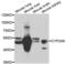 Cytochrome P450 2A6 antibody, LS-C334312, Lifespan Biosciences, Western Blot image 