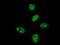 Makorin Ring Finger Protein 3 antibody, MA5-20268, Invitrogen Antibodies, Immunofluorescence image 