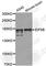 Eukaryotic Translation Initiation Factor 5B antibody, A5888, ABclonal Technology, Western Blot image 