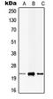 Calcium And Integrin Binding 1 antibody, orb215547, Biorbyt, Western Blot image 