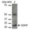 Glial Cell Derived Neurotrophic Factor antibody, LS-C773410, Lifespan Biosciences, Western Blot image 