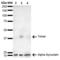 Synuclein Alpha antibody, LS-C772985, Lifespan Biosciences, Western Blot image 