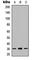 NADH:Ubiquinone Oxidoreductase Core Subunit S3 antibody, abx121945, Abbexa, Western Blot image 