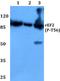 Eukaryotic Translation Elongation Factor 2 antibody, A00830T56-1, Boster Biological Technology, Western Blot image 