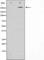 Acetyl-CoA Carboxylase Alpha antibody, abx010345, Abbexa, Western Blot image 