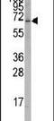 RAR Related Orphan Receptor A antibody, PA5-11224, Invitrogen Antibodies, Western Blot image 