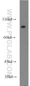 Vav Guanine Nucleotide Exchange Factor 1 antibody, 16364-1-AP, Proteintech Group, Western Blot image 