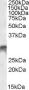 Distal-Less Homeobox 5 antibody, LS-B6489, Lifespan Biosciences, Western Blot image 