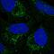 Patatin-like phospholipase domain-containing protein 3 antibody, HPA058058, Atlas Antibodies, Immunofluorescence image 