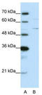 HNRPK antibody, TA345793, Origene, Western Blot image 
